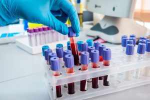 lab analisi