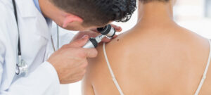 prevenzione dermatologica