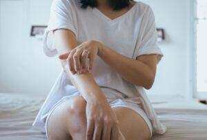 Woman,With,Rash,Or,Papule,And,Scratch,On,Her,Arm