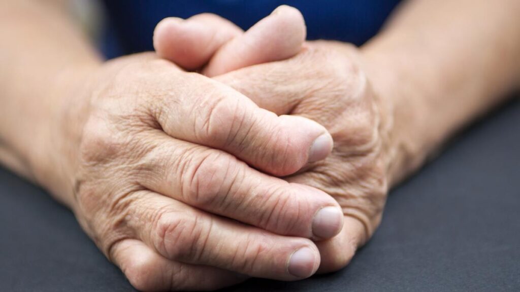 Hands Of Woman Deformed From Rheumatoid Arthritis. Holding pill