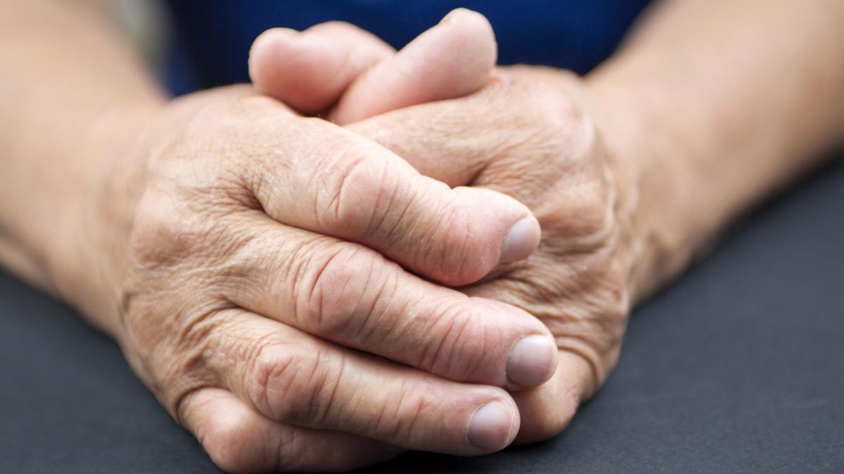 Hands Of Woman Deformed From Rheumatoid Arthritis