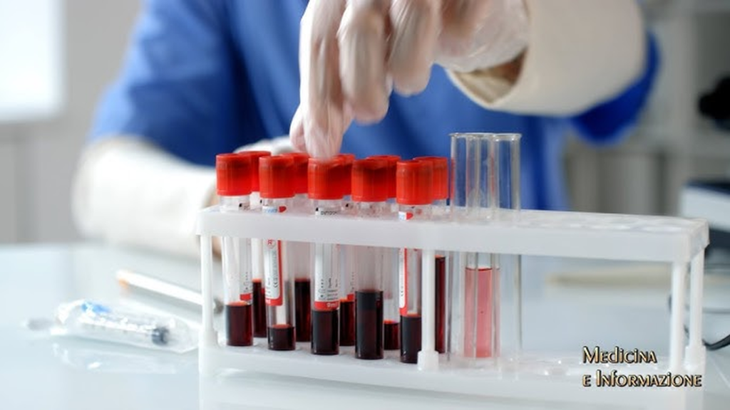 Tumori del sangue: in Italia +35mila casi ogni anno. Istituto Amadori, “nel 70% dei casi è remissione completa”